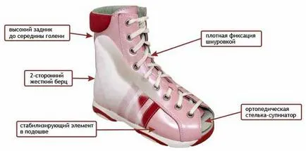 Hogyan válasszuk ki a megfelelő ortopéd cipők
