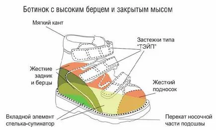 Cum de a alege pantofii ortopedice dreapta