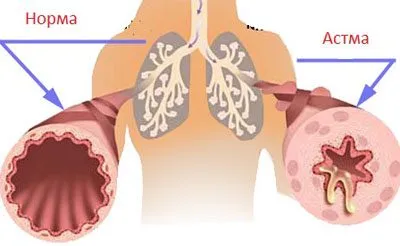 glicerol rău organismului prin inhalare și fumatul