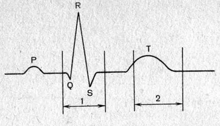 Excitabilitás - mechanizmusok szívritmuszavarok - rohamokban jelentkező tachycardia -