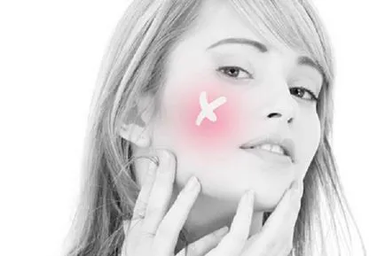 Hogyan lehet gyógyítani rosacea az arcán - a megelőzés és a kezelés a betegség