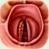 Catarală (suprafață) esofagitei esofagului H3, simptome insuficienta cardia si tratament