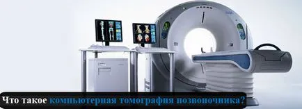 Компютърна томография на гръбначния стълб, стойността на CT на гръбначния стълб