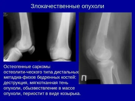 Osteo-ставния система от изследователски методи 1