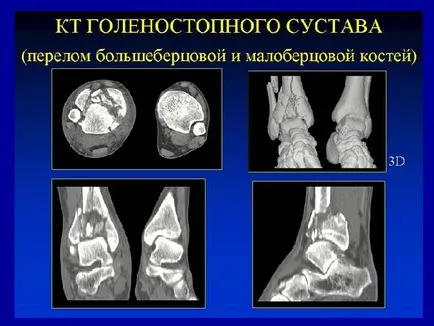 Osteo-artikuláris rendszer kutatási módszerek 1