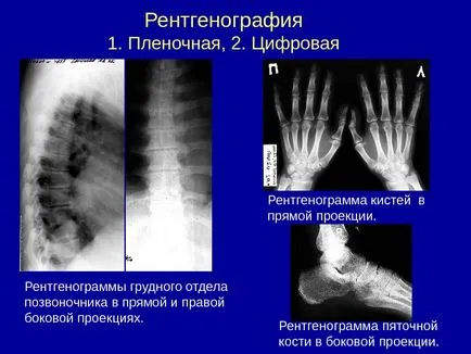 Osteo-artikuláris rendszer kutatási módszerek 1