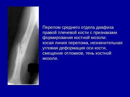 Osteo-ставния система от изследователски методи 1