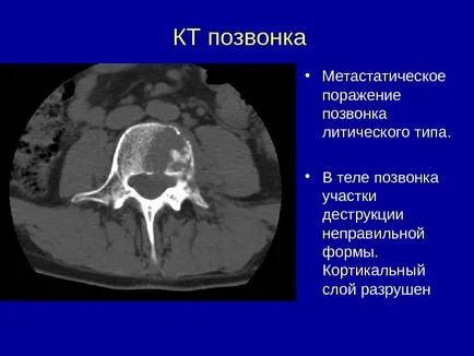 Osteo-artikuláris rendszer kutatási módszerek 1