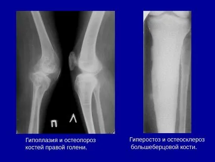 Osteo-artikuláris rendszer kutatási módszerek 1