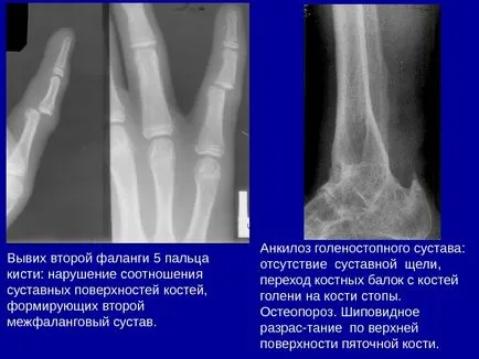 Osteo-ставния система от изследователски методи 1