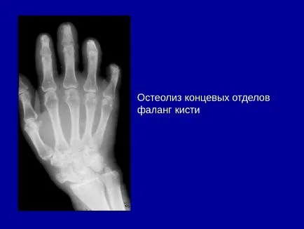 Osteo-ставния система от изследователски методи 1