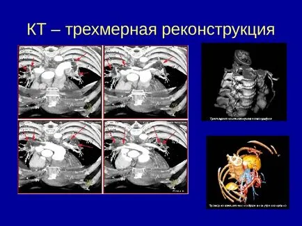 Osteo-ставния система от изследователски методи 1