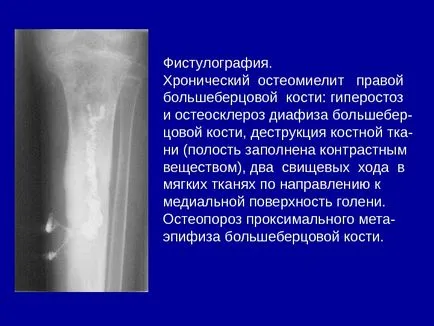 Osteo-ставния система от изследователски методи 1