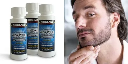 Minoxidil szakáll hatékony és megfizethető eszköz, amely felhasználható