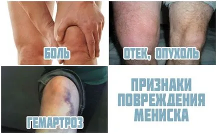 На менискуса на коляното