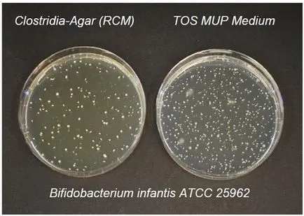 Microbii instruire (microbiologie - Merck cultură media - mediu nutritiv uscat - lista