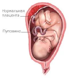 A méhlepény a terhesség alatt, alacsony placenta a terhesség alatt