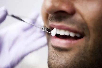 Защо боли предните зъби в долната челюст
