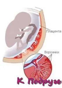 Преждевременно съзряване на плацентата 27 седмица