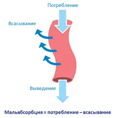 синдром на малабсорбция - класификация, симптоми, лечение