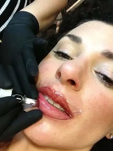 Gyógyító ajkak korrekció után - tattoo