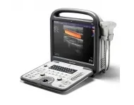 Sonoscape - gyártó ultrahangos készülékek