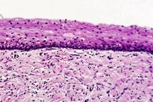 Structura de anatomie de col uterin, topografie, histologie