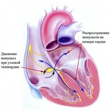 Tahicardia - ce este, tratarea simptomelor, cauzele, prevenirea, bolilor cardiovasculare