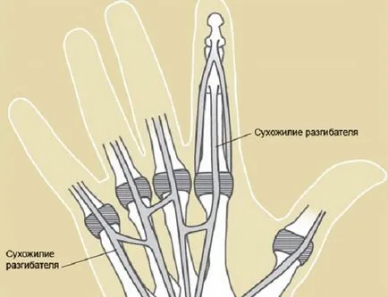 симптоми Сухожилно наранявания, признаци, диагноза и лечение