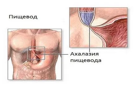 Ultrasunete a esofagului și stomacului (inclusiv un copil)