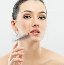 Zsíros bőr arc, mit kell tenni, hogy a probléma kezelésére