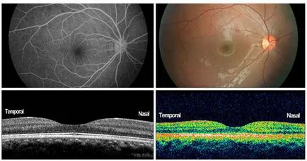 Цени и къде да се правят оптична кохерентна томография на ретината (макула, оптичен диск