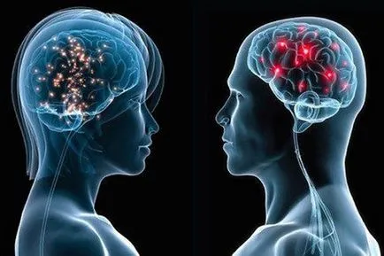 20 különbség az agy a férfiak és a nők