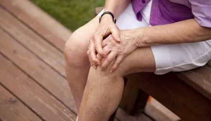 A fogyatékosság a rheumatoid arthritis
