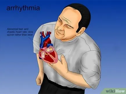 Как да разпознаем инфаркт
