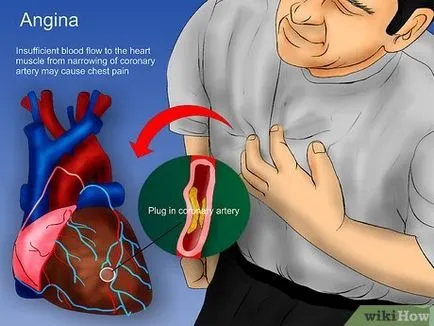 Как да разпознаем инфаркт