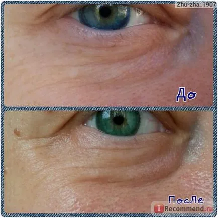 Eye Cream Belita-Vitex retinol mg - «krém - retinol mg