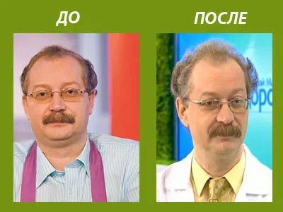 Откъде Prodeus на живо здравословно защо напусна Prodeus на живо здравословно