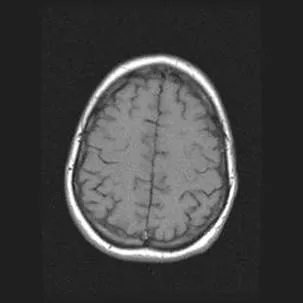 Imagistica prin rezonanta magnetica in diagnosticul diferential de accident vascular cerebral ischemic ..., publicat în