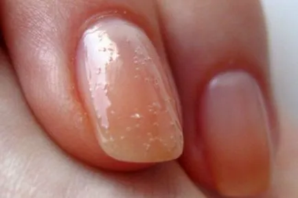 Защо гел лак за нокти пази се опитват да елиминират много грешки при създаването на красиви