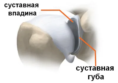 Повреда на ставните раменете устните, разходите за лечение и диагностика в Киев, Украйна