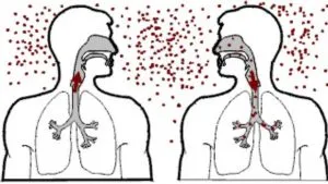 Simptome, diagnostic și tratament HIV în tuberculoză