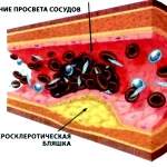 Се откажат от пушенето, без стрес и напълняване