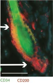 Celulele stem in lupta impotriva caderii parului