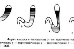 Структурата на човешкия стомах и функцията