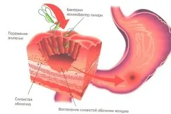 Структурата на човешкия стомах и функцията