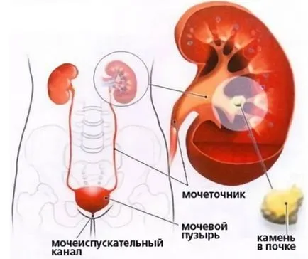 Urolesan cystitis összetételét és a hatékony fellépés a drog