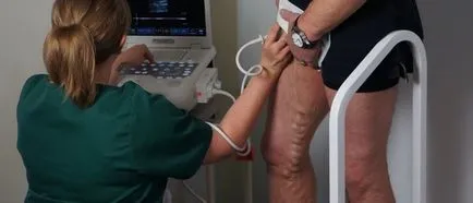 Ultrahang és Doppler ultrahang az alsó végtagok (lábak)
