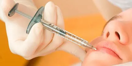 Grija buzelor după injectarea acidului hialuronic 1