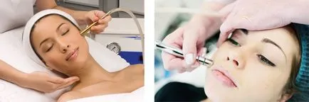 Care este diferența dintre peelingul chimic și dermabraziunea, centrul materialului plastic piept - Dikov-lea